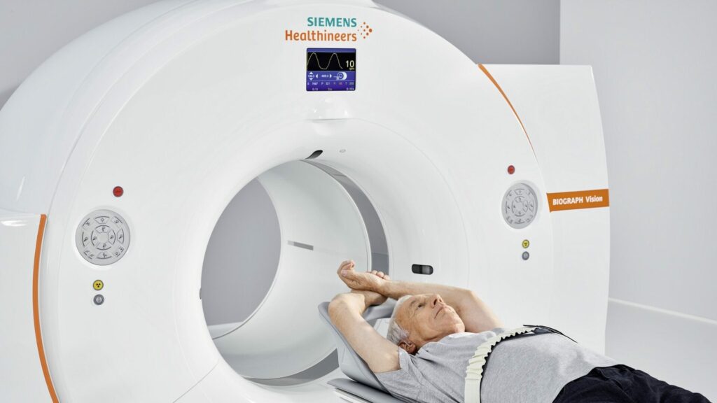 CT scan hart afbeelding